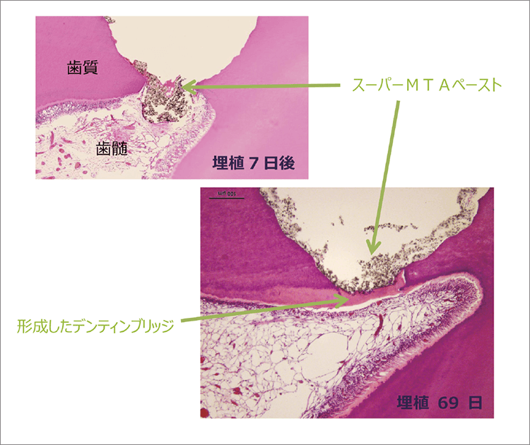 優れた生体適合性のイメージ