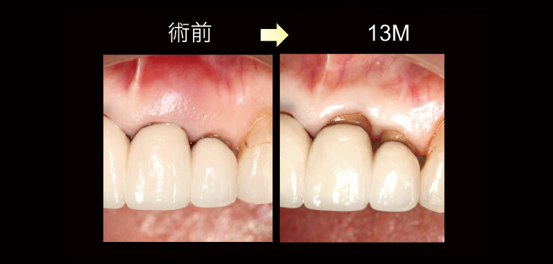 術前と術後の変化