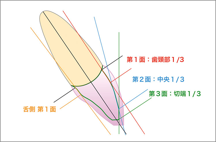 図1　切端部1/3（切縁より約2.5mm）、中央部1/3、歯頸部1/3（マージン部分より約3mm）