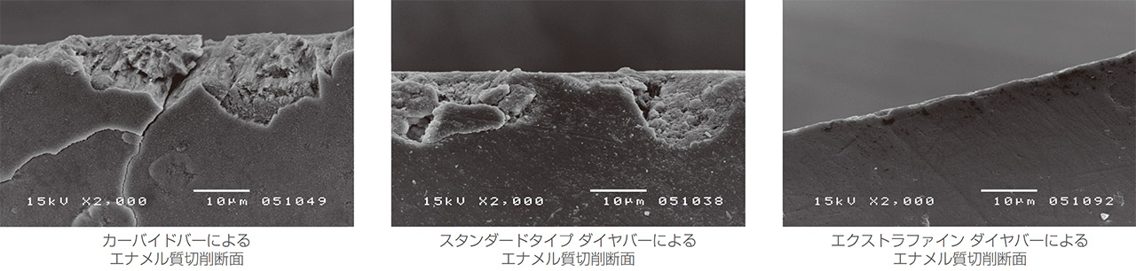 図5　切削器具の種類が窩縁部エナメル質に与える影響（西村歯科医院 西村耕三先生のご厚意による）