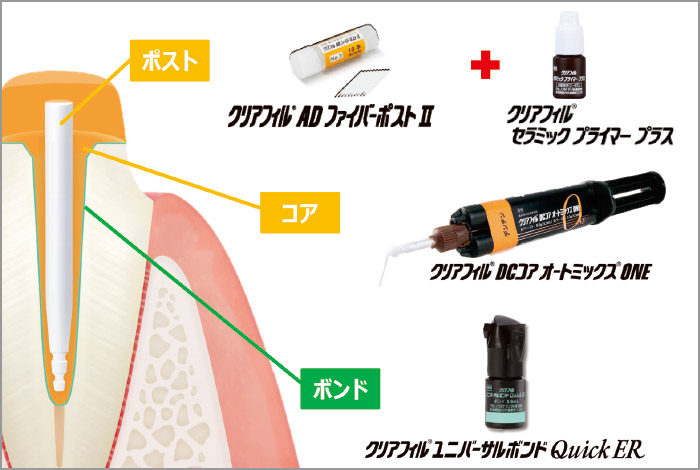 直接法における当社製品活用例