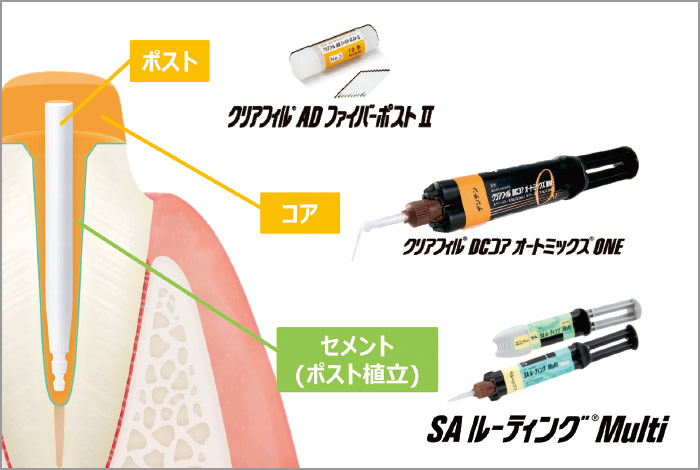 直接法における当社製品活用例（セメント併用）