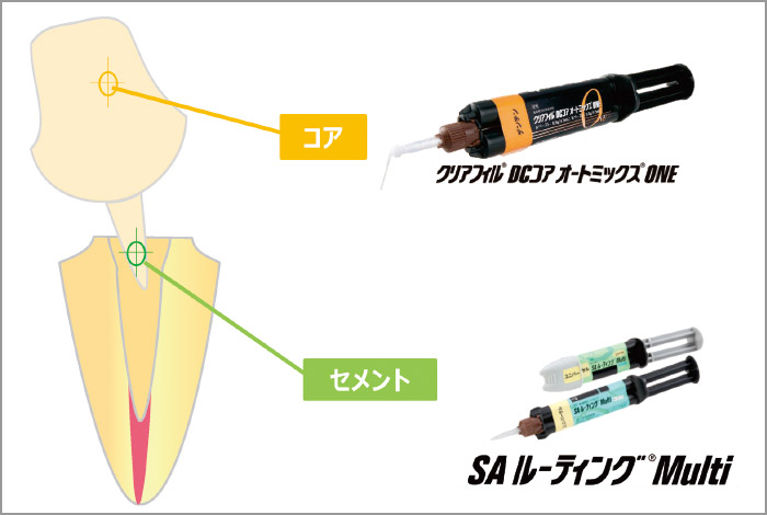 間接法における当社製品活用例</