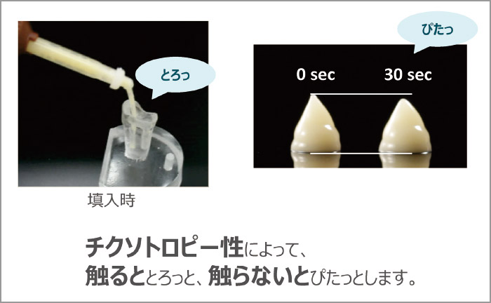 クリアフィル DCコア オートミックスの特徴