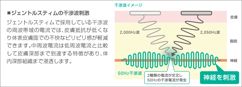 干渉波刺激のメカニズムの図