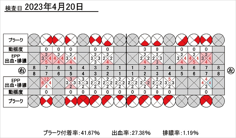 [写真] 初診時の歯周検査シート