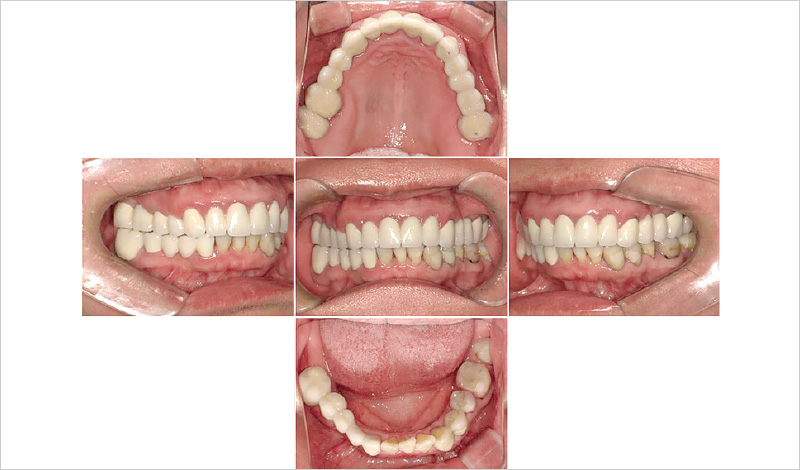 [写真] 初診時の口腔内写真