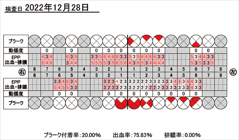 [写真] 初診時の歯周検査シート