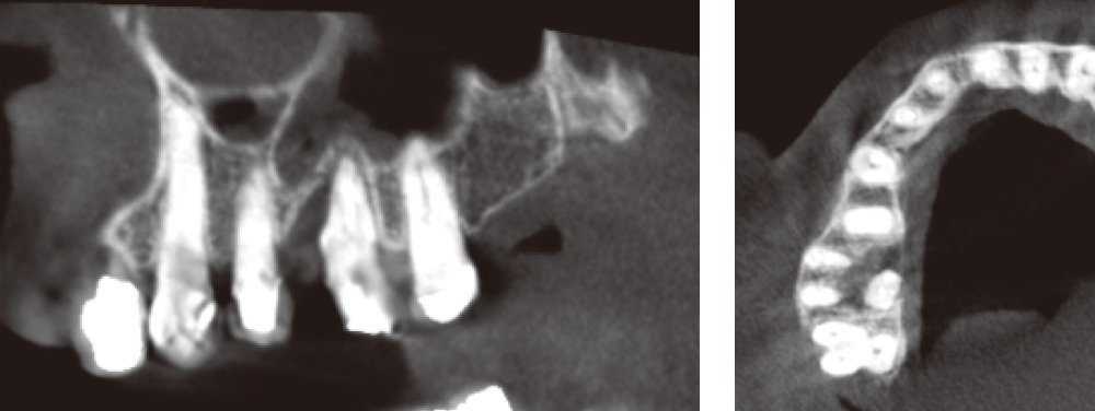 [写真] 術前CBCT