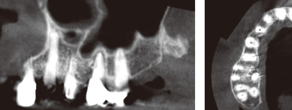 [写真] 術後CBCT