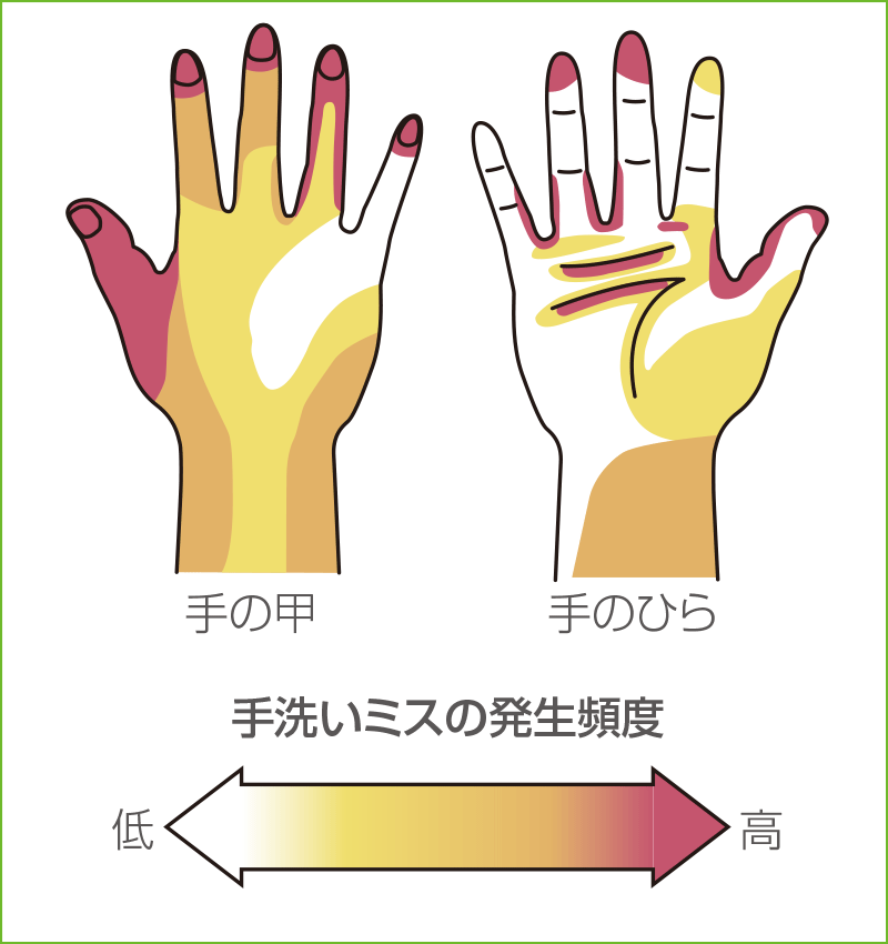 [図] 手洗いミスの生じやすい部位