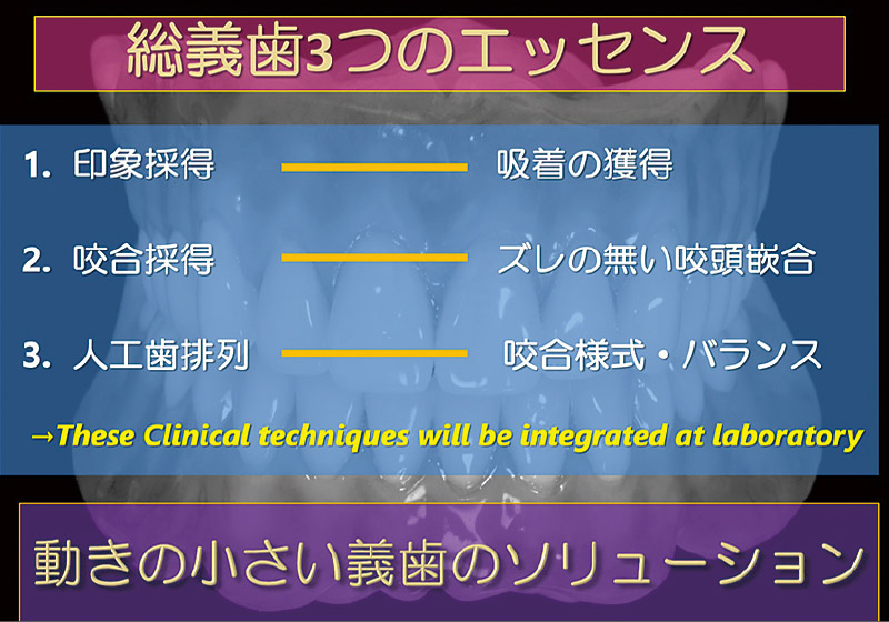 [図] 総義歯3つのエッセンス
