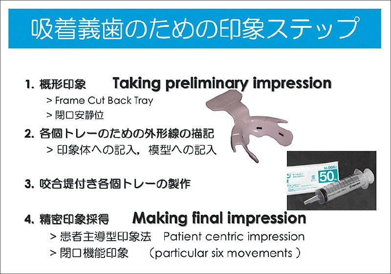 [図] 吸着義歯のための印象ステップ