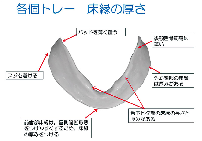[図] 各個トレー 床縁の厚さ