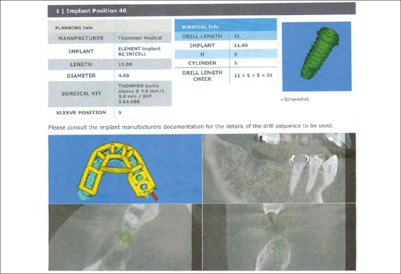 [写真] マッチングデータレポート（CBCT : RF社製NAOMI-CTにて撮影）