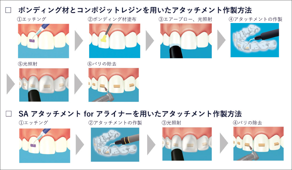 [図] アタッチメント作製方法