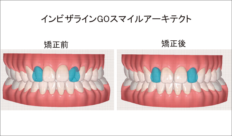 [写真] 治療計画を単一のプラットフォームで視覚化