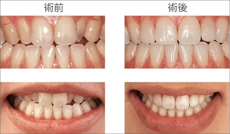 [写真] 術前と術後の比較