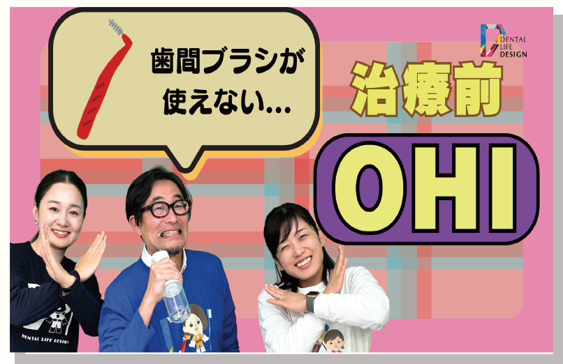 [写真] 歯周治療