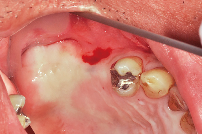 [写真] 症例① 術直前