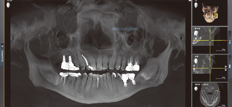 [写真] X-Ray画像