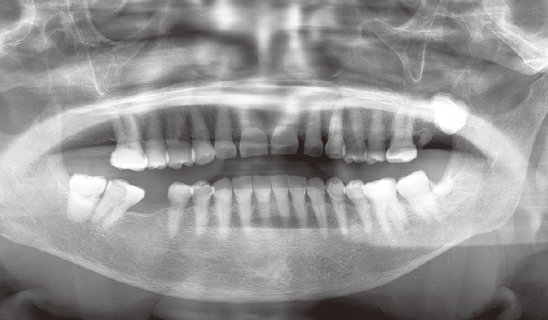 [写真] 70代女性