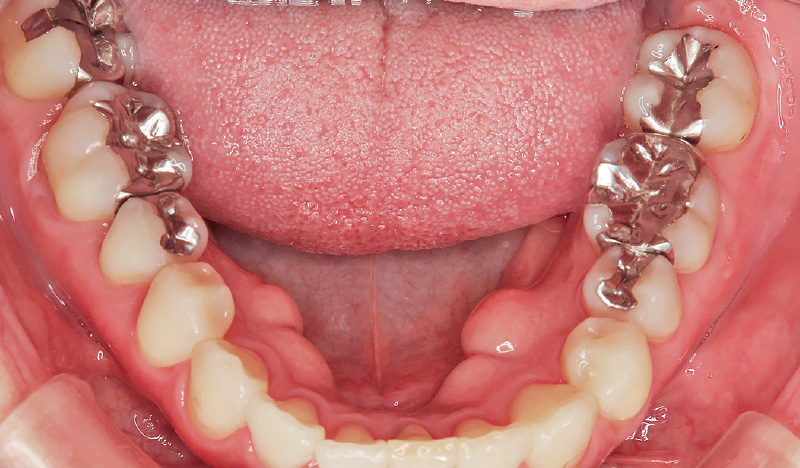 [写真] 50代女性