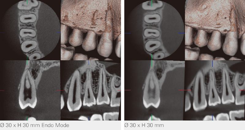 [写真] Endoモード