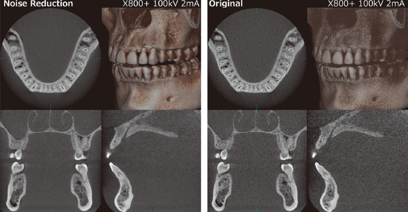 [写真] ノイズリダクションモード