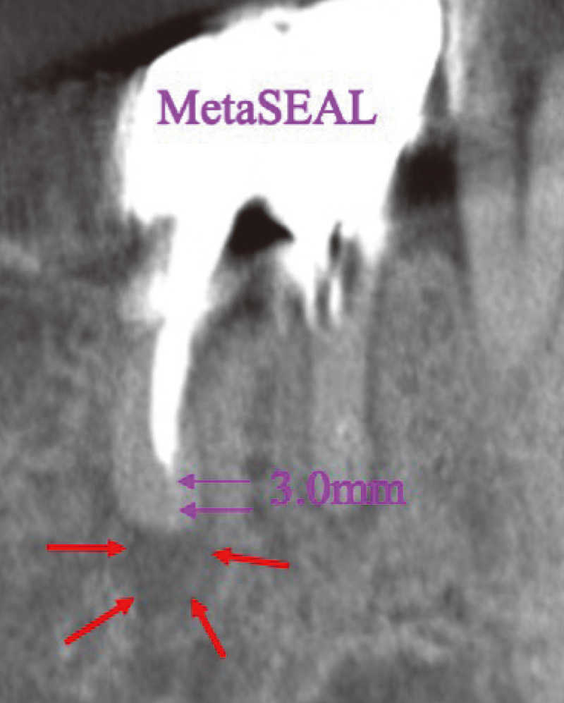 [写真] HFCから5か月経過