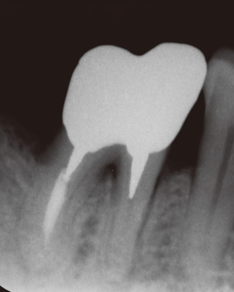 [写真] HFCから1年経過