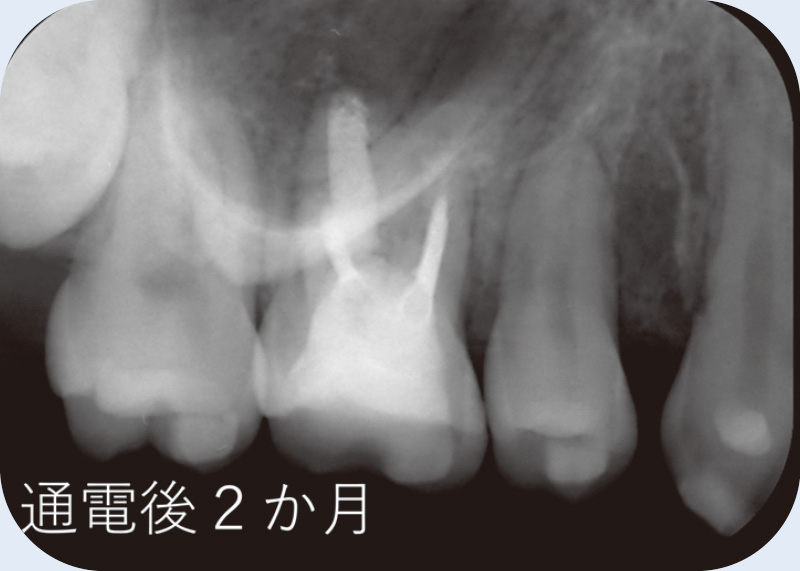 [写真] 通電後2か月