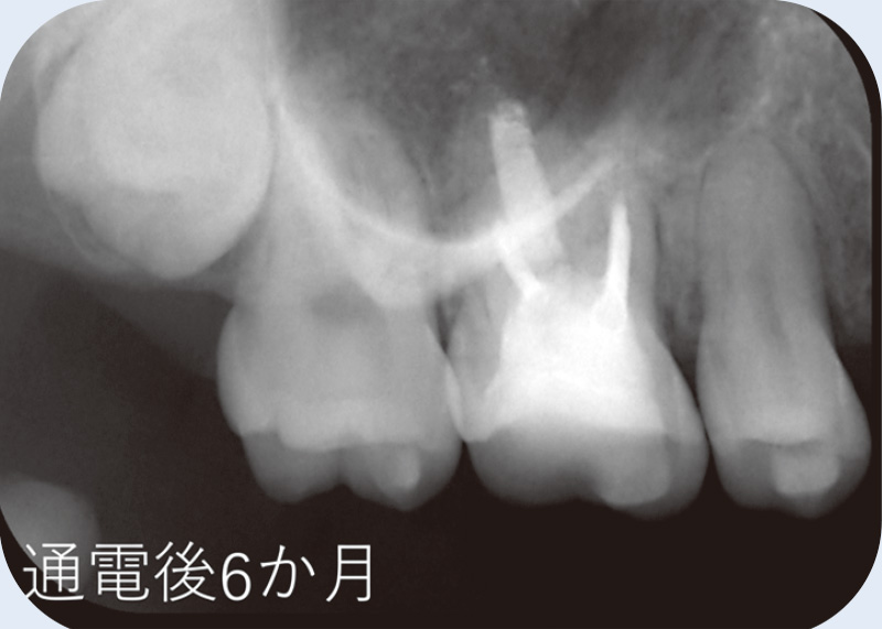 [写真] 通電後6か月