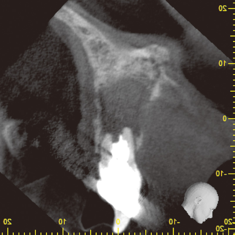 [写真] 初診時CBCT画像