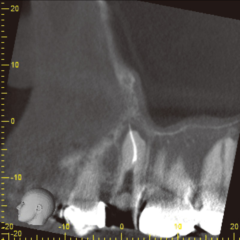 [写真] 初診時CBCT画像