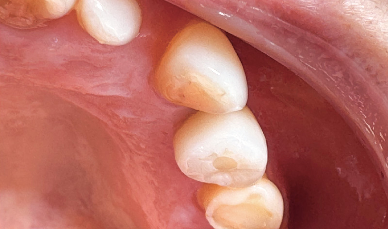 [写真] 上部構造セット