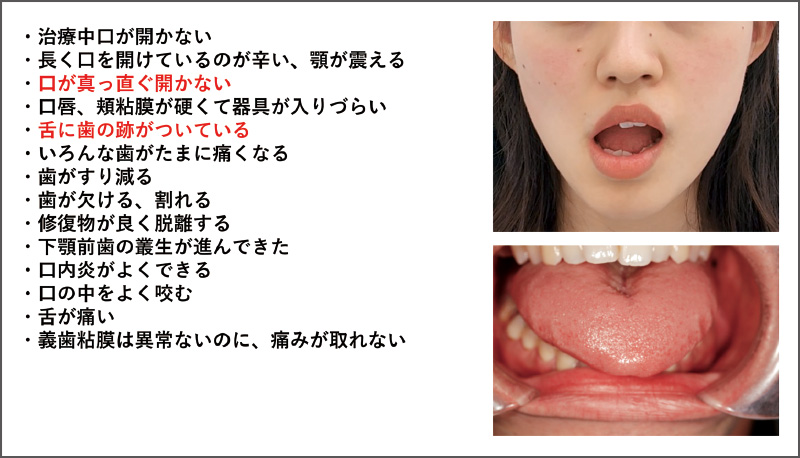 [図] かくれ顎関節症を疑う症状