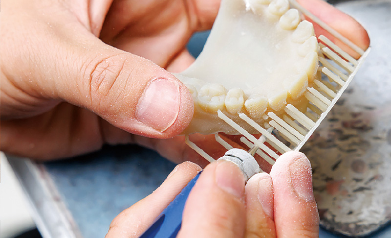 [写真] プリントされた試適用義歯のスプルーを根元から1本ずつカットしていく