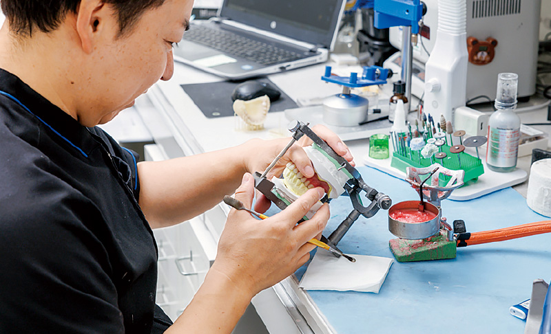 [写真] 排列を確認しながら、歯肉形成を行う