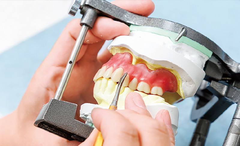 [写真] 義歯製作