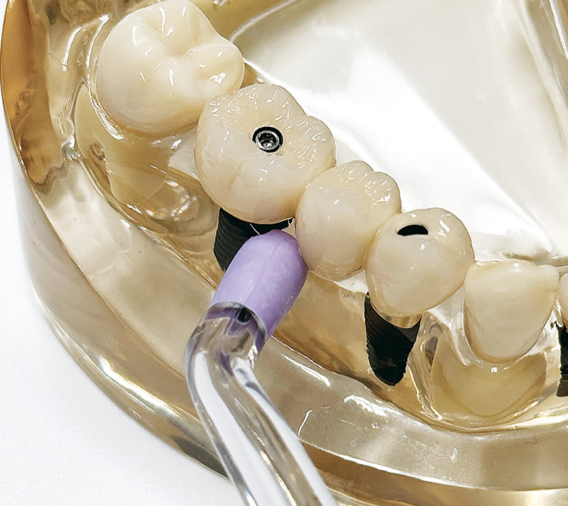 [写真] 沿って90°になるように向ける