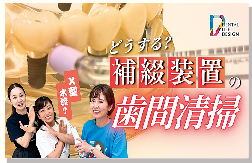 [写真] 歯周治療