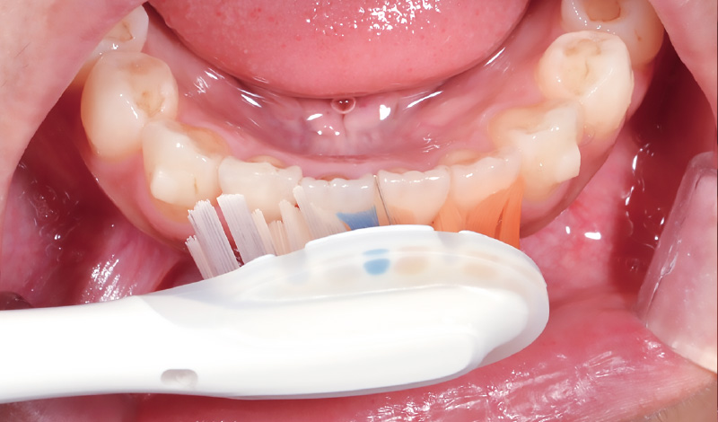 [写真] プレミアムオールインワンブラシを使用する様子