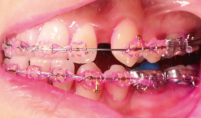 [写真] 同側面観