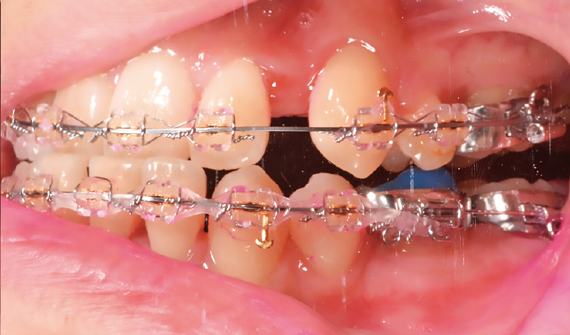 [写真] 同側面観