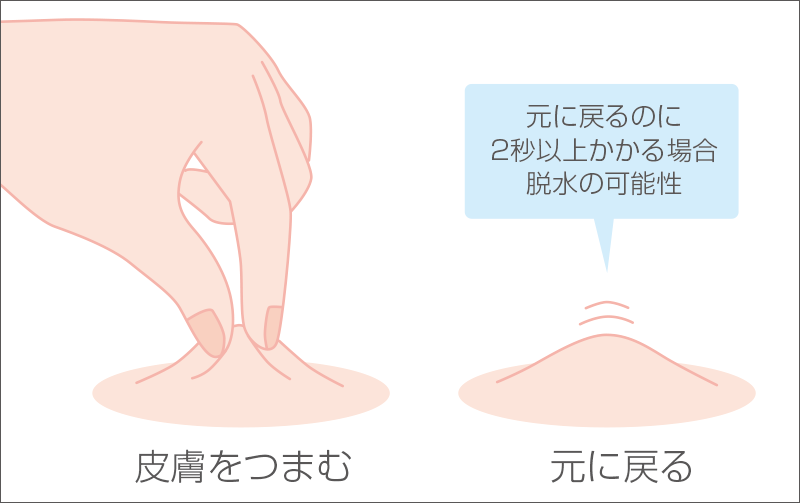 [図] ツルゴール反応　※イメージ