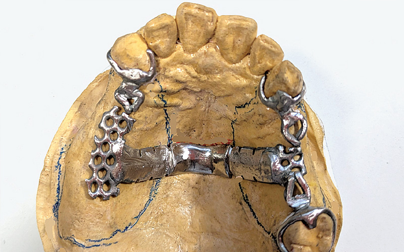 [写真] 鋳造体（研磨後）