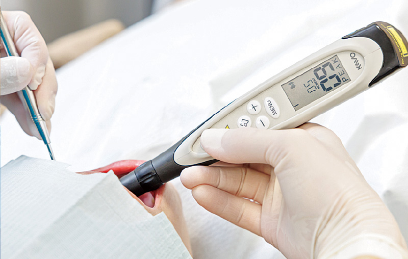 [写真] ダイアグノデント ペン