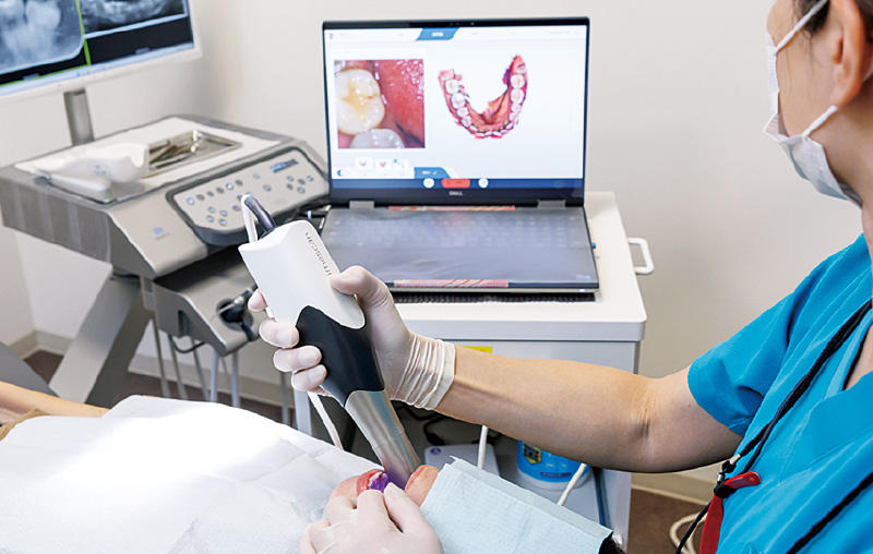 [写真] Primescan Connect