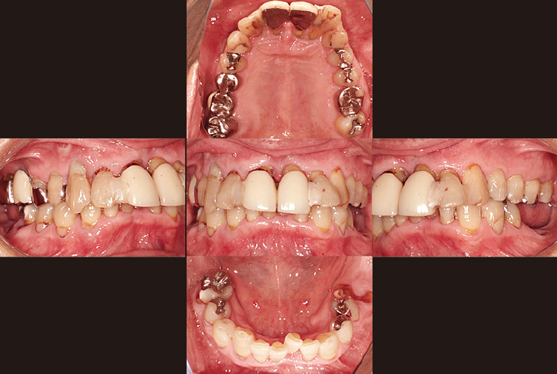 [写真] 初診時74歳男性